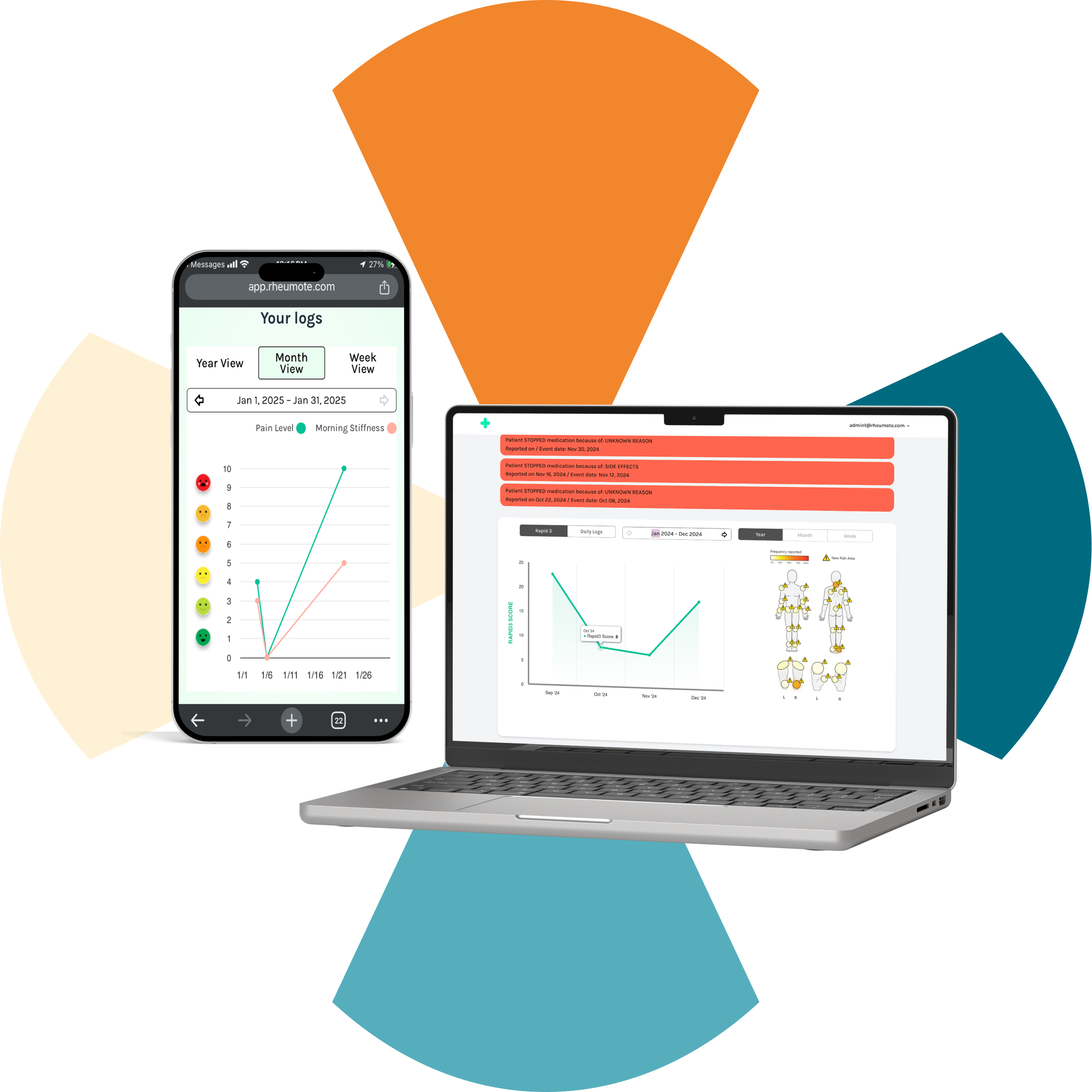 Rheumote Control Challenges